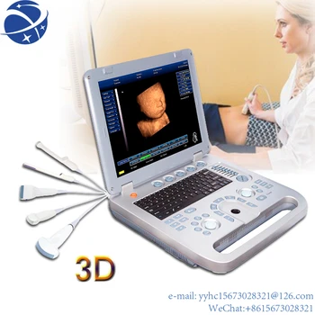 Yun Yi Sun-800D Lage Kosten Nešiojamas Ziekenhuis 3D Ob Gyn Echografie Mašina Susitiko Hoge Kwaliteit
